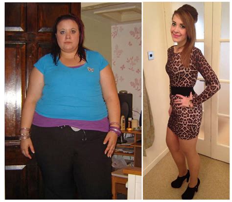 21 Year Old Virgin Hazel Dyson Lost 12 ½ Stone And Gained