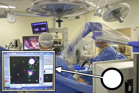 Intraoperative Imaging For Sentinel Node Identification In Prostate