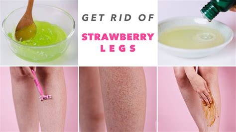 Get Rid Of Strawberry Legs Youtube