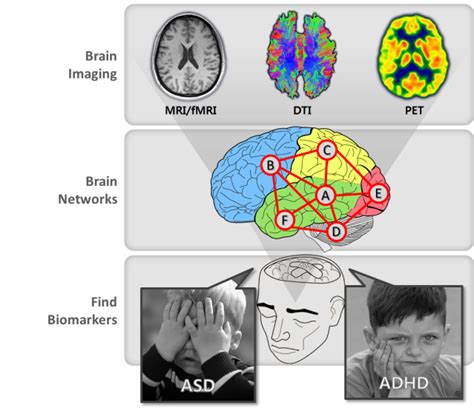 Developmental Disorder Cognitive Neuroimaging Lab
