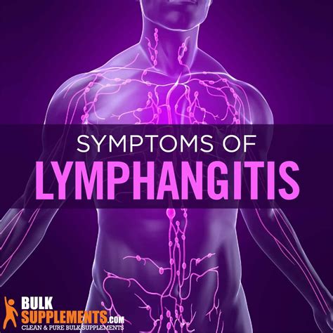 Lymphangitis Discover Quick Treatments And Healthy Supplements