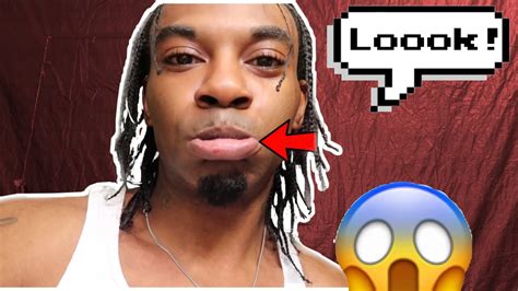 how i busted my lip a v vlog youtube