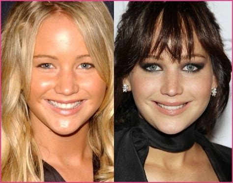 Klik op de opnameknop om uit te spreken helaas, deze browser ondersteunt geen stem opnemen helaas, dit apparaat biedt geen ondersteuning voor de. Emilia clarke plastic surgery - Plastic Surgery » Plastic ...