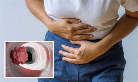 Bowel Cancer Symptoms Pain Or A Lump In Your Stomach Area And Pale