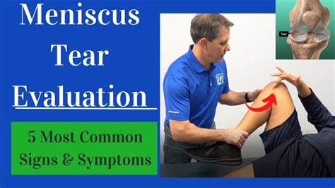 Meniscus Tear Evaluation Most Common Signs And Symptoms Youtube