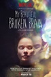 Assistir My Beautiful Broken Brain (2016) Online Dublado Full HD