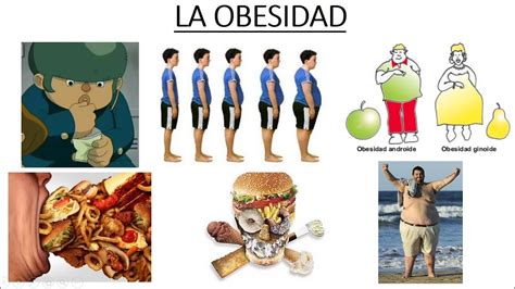 La Obesidad Factores Que Influyen En Su Aparición Y Clasificación De Los Diferentes Tipos Vidoe