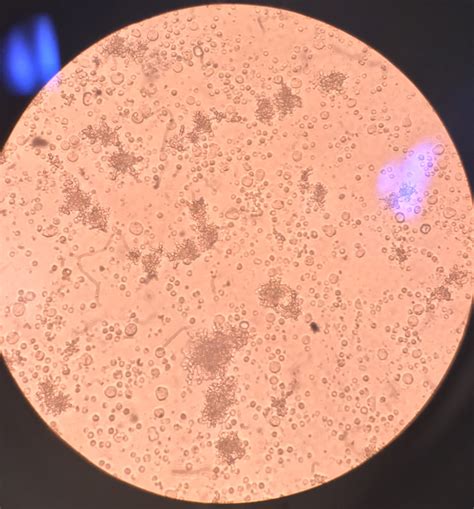Cell culture contamination? (pics) : labrats