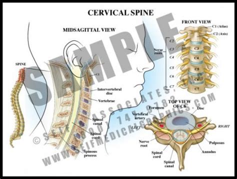 Cervical Spine Sanda Medical Graphics