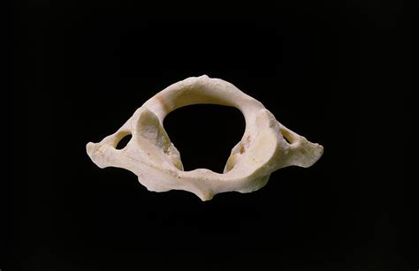 First Cervical Atlas Vertebra Of Neck Photograph By James Stevenson