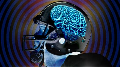 But cte can be definitively diagnosed only after a person has died, during an examination of the person's brain, according to researchers at boston among the brains of nfl players, 110 out of 111, or 99 percent, had cte. Shame on NFL for making players beg in concussion ...