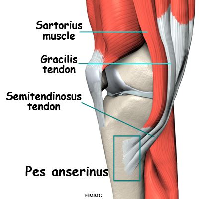 Pes Anserine Bursitis Of The Knee Eorthopod Com