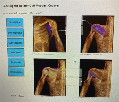 Labeling The Rotator Cuff Muscles Cadaver What Are
