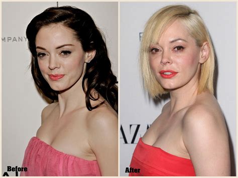 Consider About The Appearance Of Rose Mcgowan Plastic Surgery