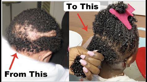 10 Tips For Non Stop Hair Growth Your Childs Hair Will Never Stop