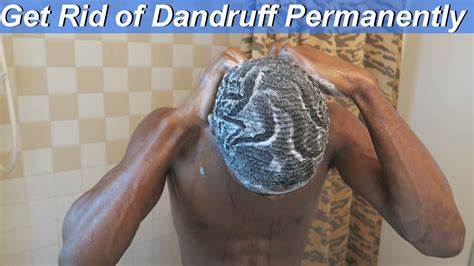 This word comes to us straight from latin. How to Get Rid of Dandruff at Home: Naturally ...