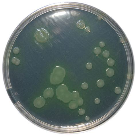 Pseudomonas Agar Base With 1 Glycerol And Cfc Selective Supplement E