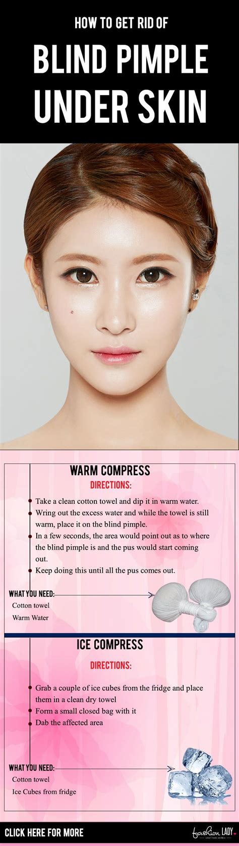 How To Get Rid Of Blind Pimple Under Skin Hormonal Acne Treatment Spot