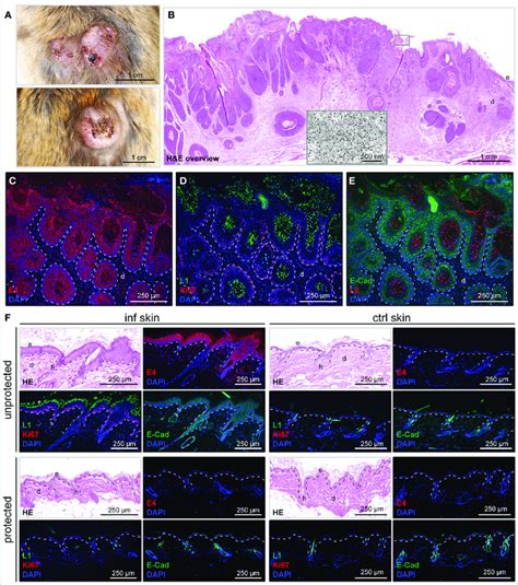 Histological Characterization Of MnPV Induced Skin Changes And Tumor
