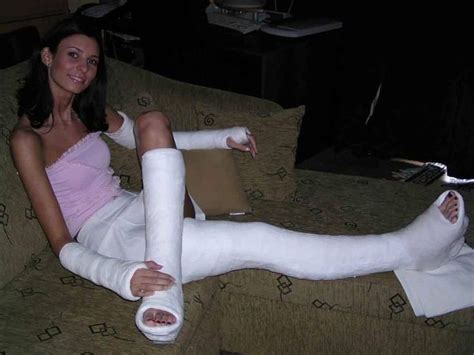 how to make a leg cast for halloween ann s blog