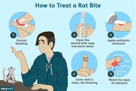 Rat Bites At Home First Aid And Rat Bite Fever Treatment