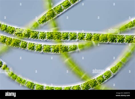 Light Micrograph Of Zygnema Sp Freshwater Filamentous Green Algae