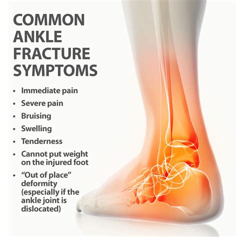 Ankle Injuries Dislocation Impingement Sprain Fracture Peroneal Tendon