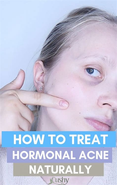 How To Treat Hormonal Acne Naturally 8 Treatments Cushy Spa