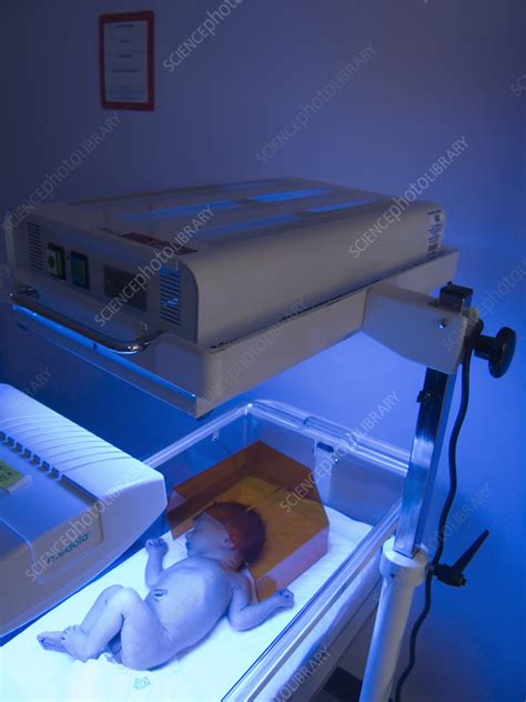 Bilirubin Light Therapy For Babies Americanwarmoms Org