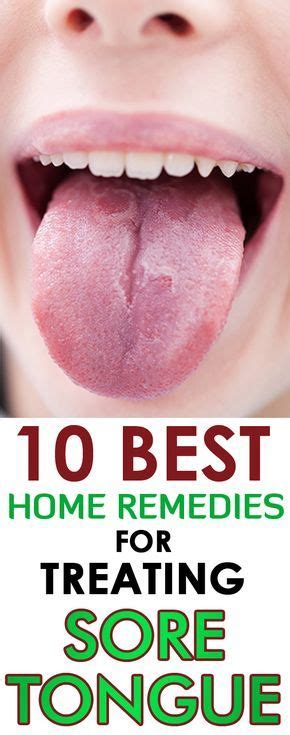 Home Remedies For Treating Sore Tongue Tongue