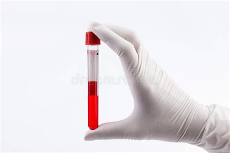 Hand Reagenzglas Mit Blutplasma Hält Stockfoto Bild von doktor forschung