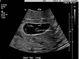 Ytes i was given my dating scan at 10+2. Ultrasound dating acog, methods for estimating the due date