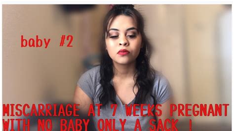 Miscarriage At 7 Weeks Pregnant Story Time Youtube