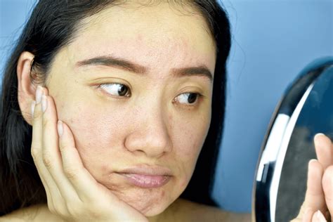 5 Ways To Rejuvenate Dull Skin Apt Medical Aesthetics