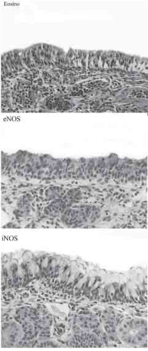 Light Photomicrographs Of NOS Immunohistochemistry And H E Stained