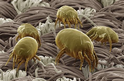 These dust mite pictures show you what's living in your pillow and mattress. M is for Mighty Mite