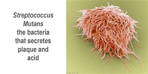 Streptococcus Sobrinus