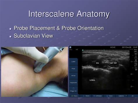 Ppt Ultrasound Guided Regional Anesthesia Powerpoint Presentation