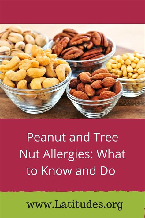 Peanut And Tree Nut Allergies What To Know And Do Premium Artofit