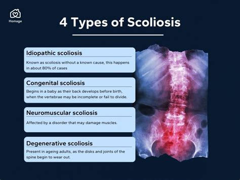Understanding Scoliosis Types Causes Symptoms And Treatment