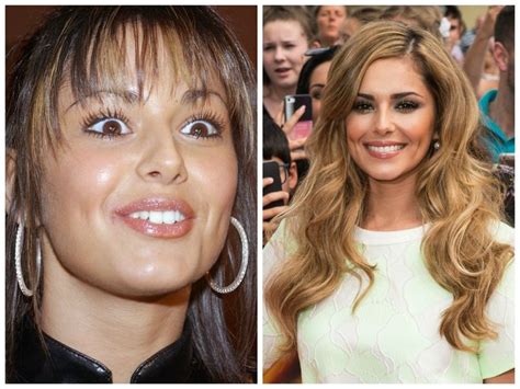 Celebrity Teeth Before And After Smile Makeovers Celebrity Teeth