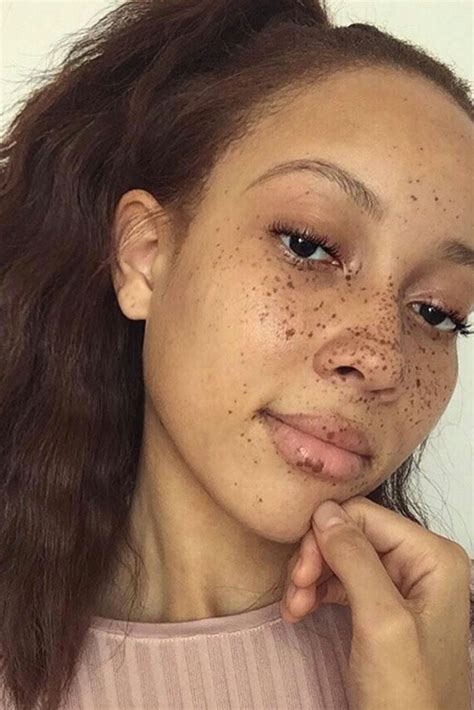 26 Beautiful Black Women Flaunting Their Freckles Essence