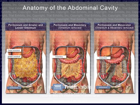 Check spelling or type a new query. Anatomy of the Abdominal Cavity - TrialExhibits Inc.