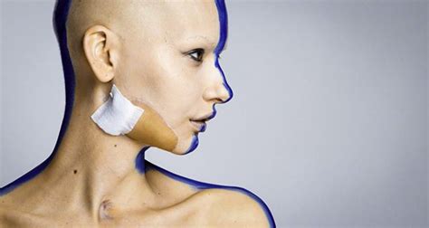 This Incredible Woman Returned To Modeling After She Lost Her Jaw To Cancer