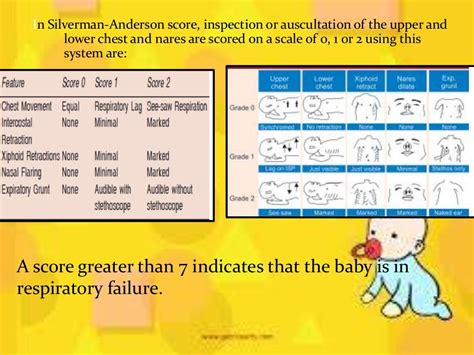 Respiratory Distress Syndrome In A Premature Baby