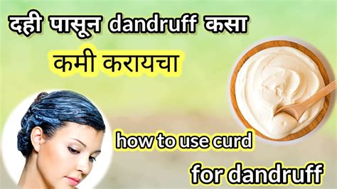 दही पासून Dandruff कसा कमी करायचा How To Use Curd In Dandruff