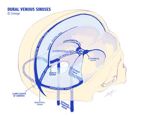 Dural Venous Sinuses Neurology Medbullets Step