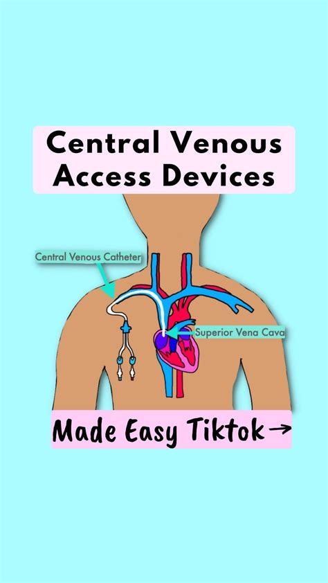 central venous catheter nursing school life nclex review nclex prep subcutaneous tissue