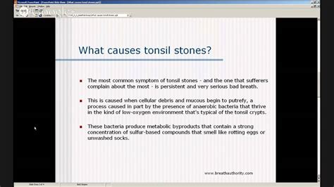 Tonsil Stones Causes What Causes Tonsil Stones Youtube
