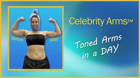 Arm Liposuction Celebrity Arms Lipo High Definition